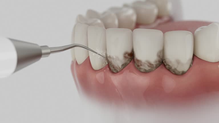 Reliable Emergency Dentist contractor in Newton County County, IN by Dentist Open Now